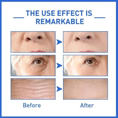 Botox Anti-Aging Serum, Youthfully Botox Face Serum(Pack Of 1)