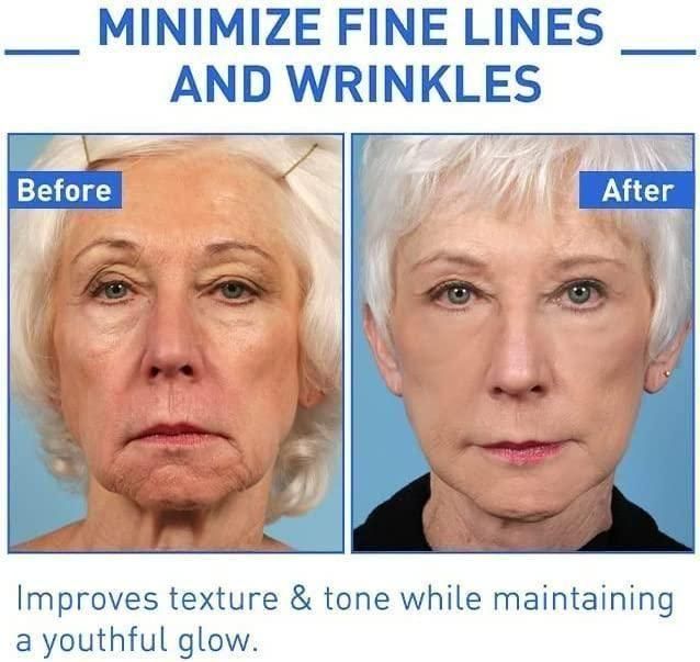 Botox Anti-Aging Serum, Youthfully Botox Face Serum- BUY 1 GET 1 FREE!