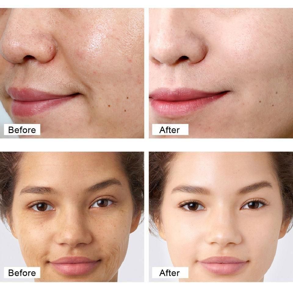 Anti-Aging Retinol Face Cream For Brightening & Moisturizing Facial Skin (Pack Of 1)- 50g